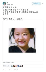 吉岡里帆目頭切開
