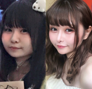 戦慄かなの,整形前後
