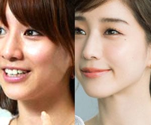 田中みな実, あご, 横顔, 変わった