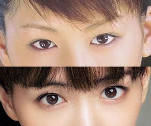 綾瀬はるか, 整形, 疑惑, 比較, 昔の画像, 目