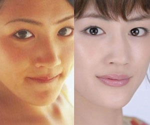 綾瀬はるか, 整形, 疑惑, 顔, 比較, 昔の画像